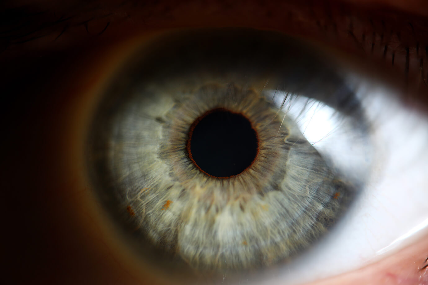 Irisdiagnostika - oči ako zrkadlo zdravia